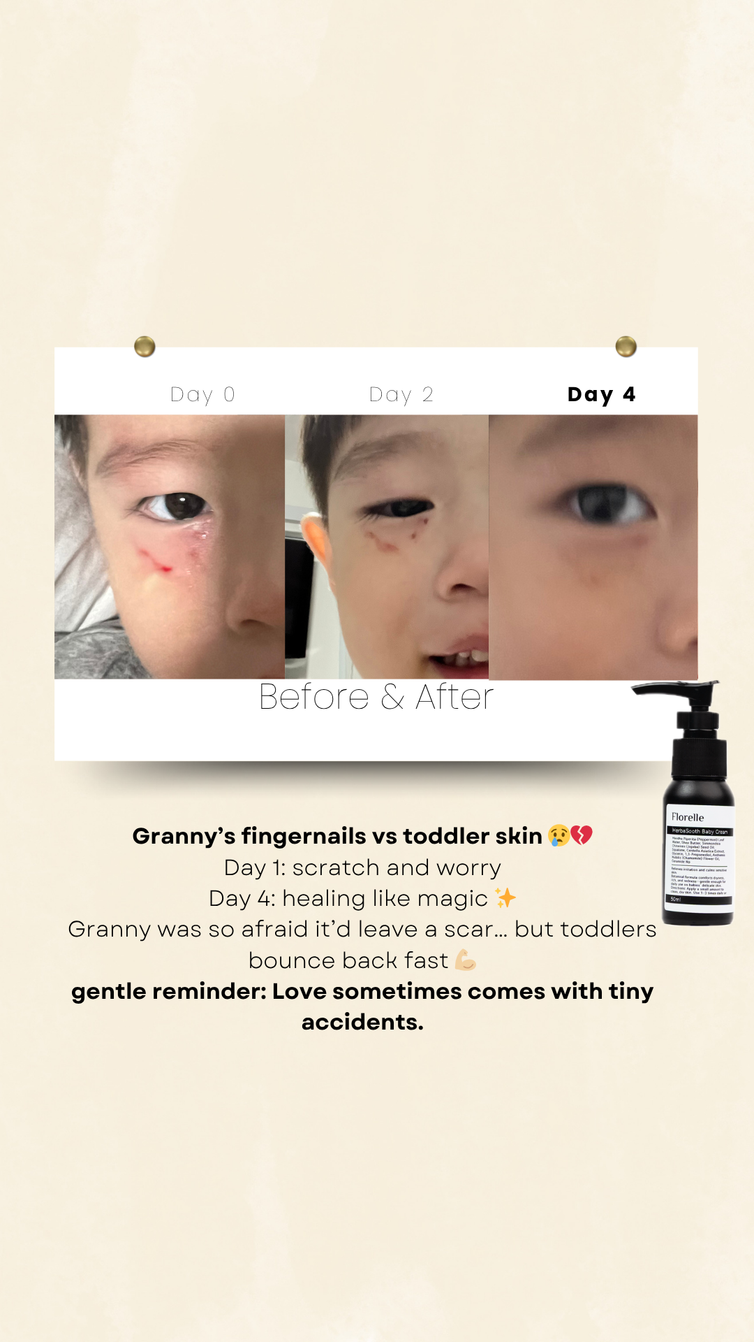 HerbaSooth Baby Cream