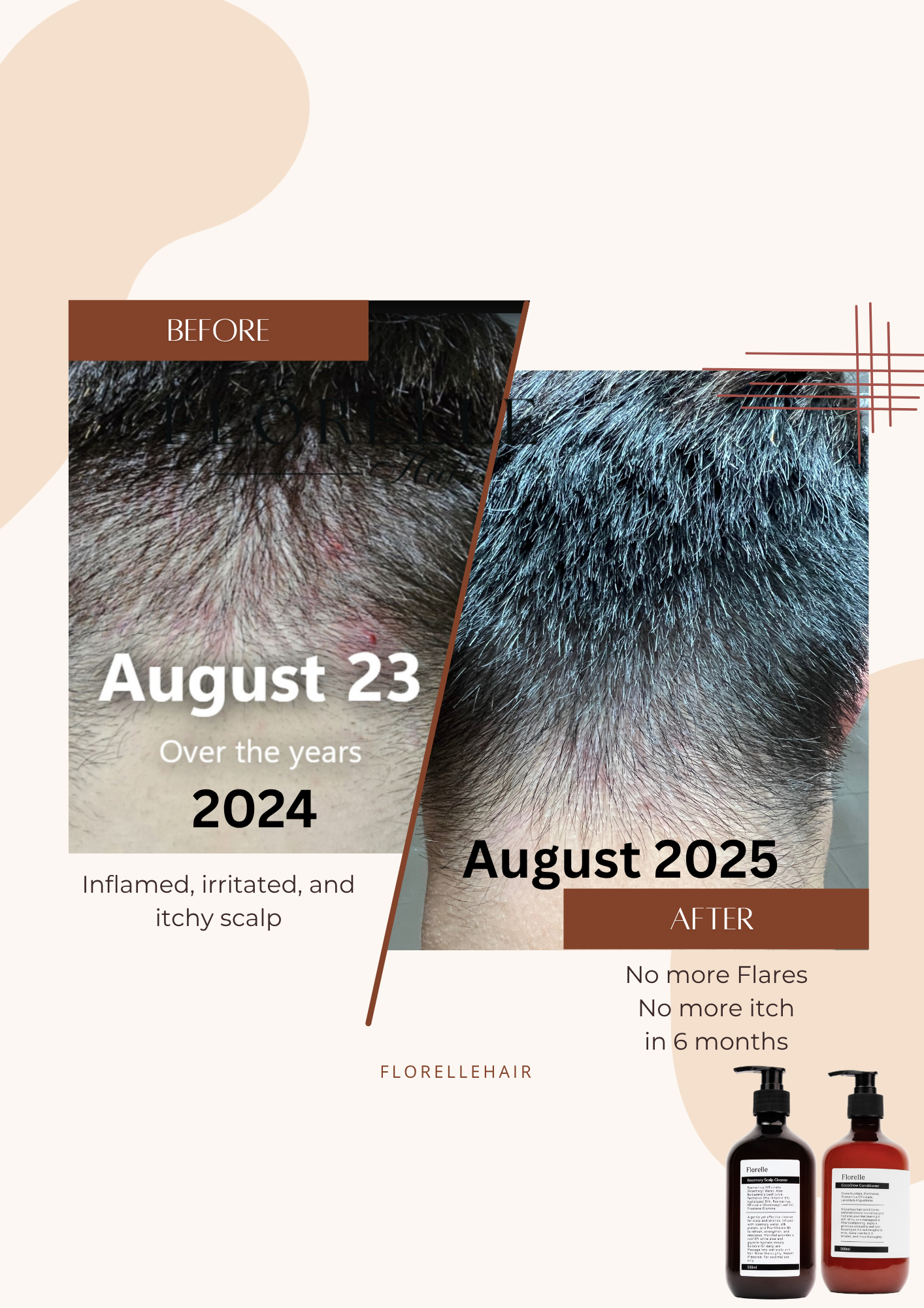 Haircare Trio for Damaged Hair & Scalp